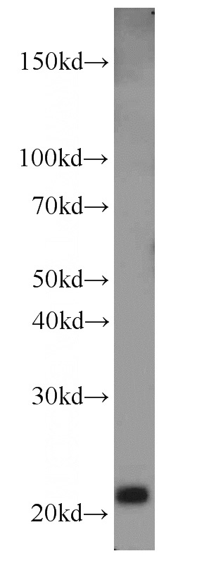 HEK-293 cells were subjected to SDS PAGE followed by western blot with Catalog No:112500(MAX antibody) at dilution of 1:300