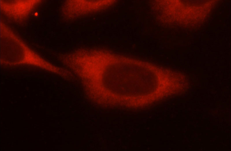 Immunofluorescent analysis of HeLa cells using Catalog No:113772(PFKM Antibody) at dilution of 1:25 and Rhodamine-Goat anti-Rabbit IgG