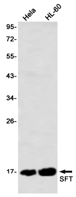 Western blot detection of SFT in Hela,HL-60 using SFT Rabbit mAb(1:1000 diluted)