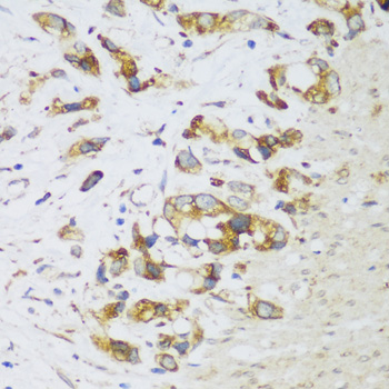 Immunohistochemistry - ERLIN1 Polyclonal Antibody 