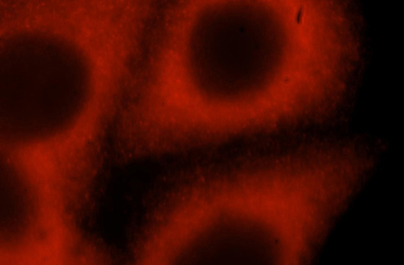 Immunofluorescent analysis of HepG2 cells, using ABL2 antibody Catalog No:107818 at 1:25 dilution and Rhodamine-labeled goat anti-rabbit IgG (red).