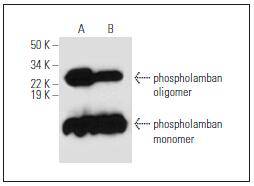 Fig1: Western blot analysis of phospholamban expression in mouse heart (A) and human heart (B) tissue extracts.