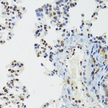 Immunohistochemistry - BAZ1B Polyclonal Antibody 