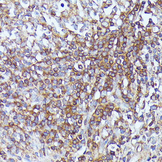 Immunohistochemistry - SEPT1 Polyclonal Antibody 