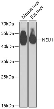 Western blot - NEU1 Polyclonal Antibody 
