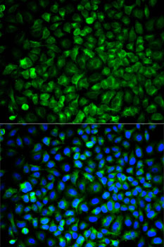Immunofluorescence - COMT Polyclonal Antibody 