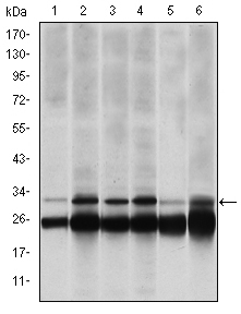 Western blot analysis using PSMB8 mouse mAb against Hela (1), MCF-7 (2), A431 (3), RAJI (4), MOTL4 (5) and PC-12 (6) cell lysate.