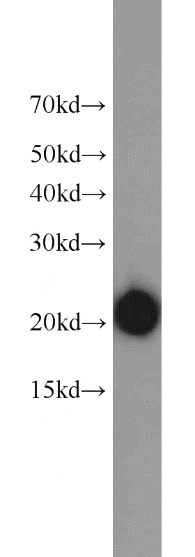 Jurkat cells were subjected to SDS PAGE followed by western blot with Catalog No:108355(ATP5H antibody) at dilution of 1:3000