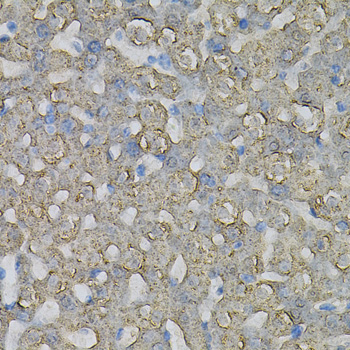 Immunohistochemistry - INPP5J Polyclonal Antibody 