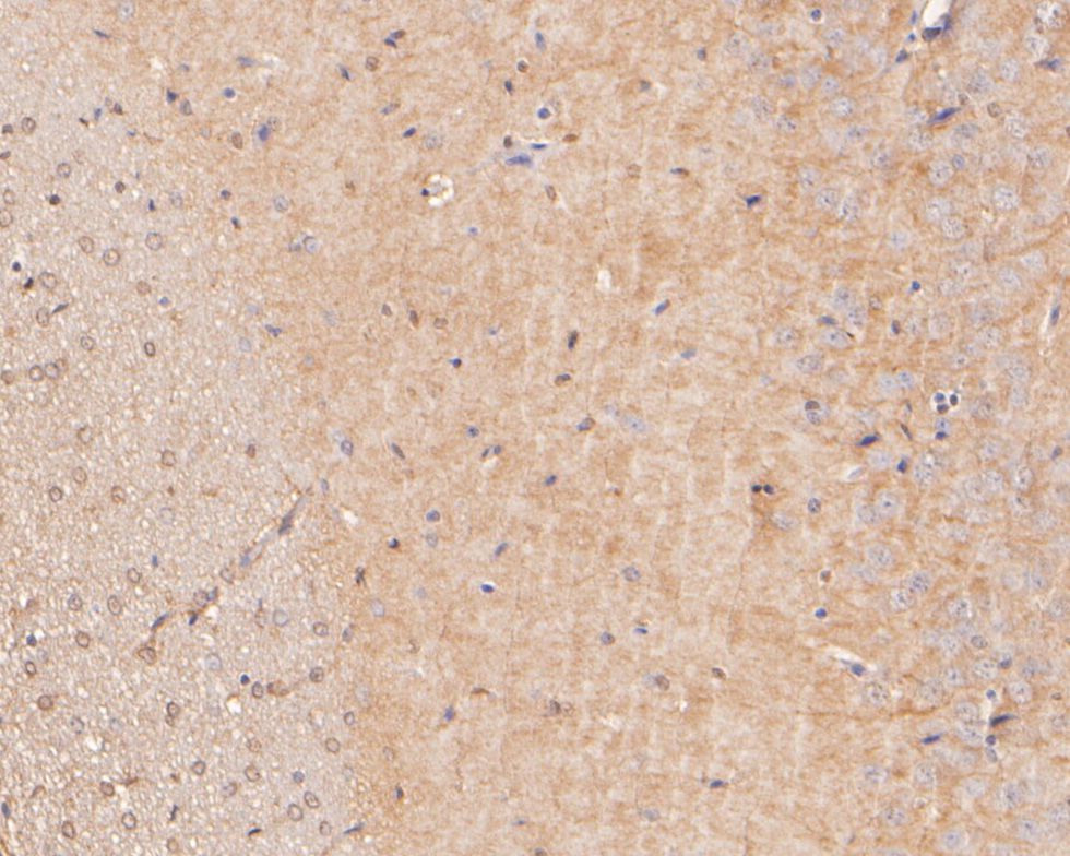 Fig3:; Immunohistochemical analysis of paraffin-embedded rat brain tissue using anti-Neurabin 1 antibody. The section was pre-treated using heat mediated antigen retrieval with Tris-EDTA buffer (pH 8.0-8.4) for 20 minutes.The tissues were blocked in 5% BSA for 30 minutes at room temperature, washed with ddH; 2; O and PBS, and then probed with the primary antibody ( 1/400) for 30 minutes at room temperature. The detection was performed using an HRP conjugated compact polymer system. DAB was used as the chromogen. Tissues were counterstained with hematoxylin and mounted with DPX.