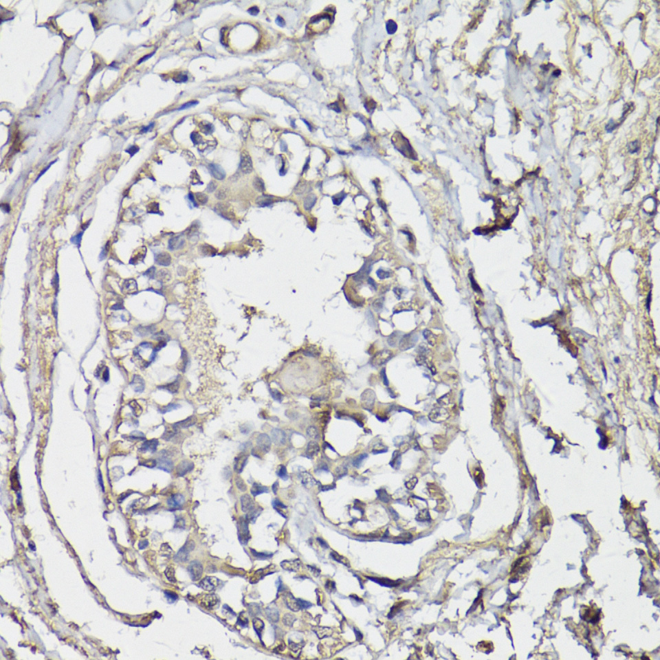 Immunohistochemistry - BAP1 Polyclonal Antibody 