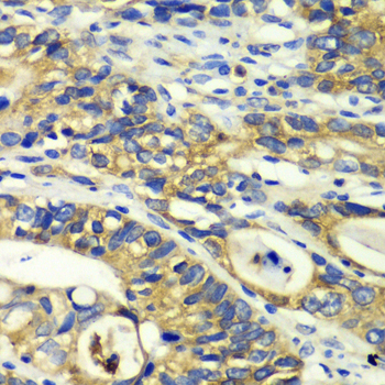 Immunohistochemistry - RPH3A Polyclonal Antibody 
