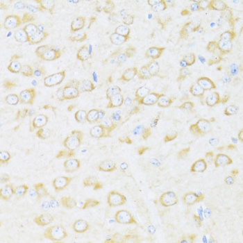 Immunohistochemistry - DDX3Y Polyclonal Antibody 