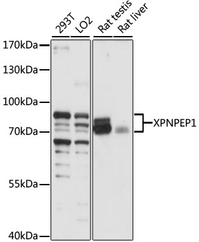 Western blot - XPNPEP1 Polyclonal Antibody 