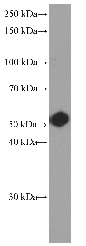 SH-SY5Y cells were subjected to SDS PAGE followed by western blot with Catalog No:107205(Fascin Antibody) at dilution of 1:2000