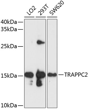 Western blot - TRAPPC2 Polyclonal Antibody 