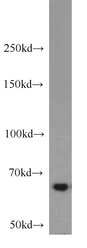 HepG2 cells were subjected to SDS PAGE followed by western blot with Catalog No:111681(IGF2BP3 antibody) at dilution of 1:1000