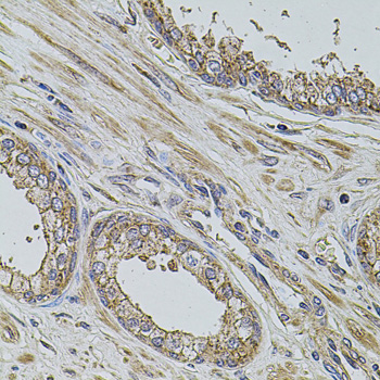 Immunohistochemistry - ALIX / PDCD6IP Polyclonal Antibody 