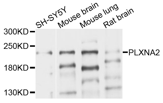 Western blot - PLXNA2 Polyclonal Antibody 