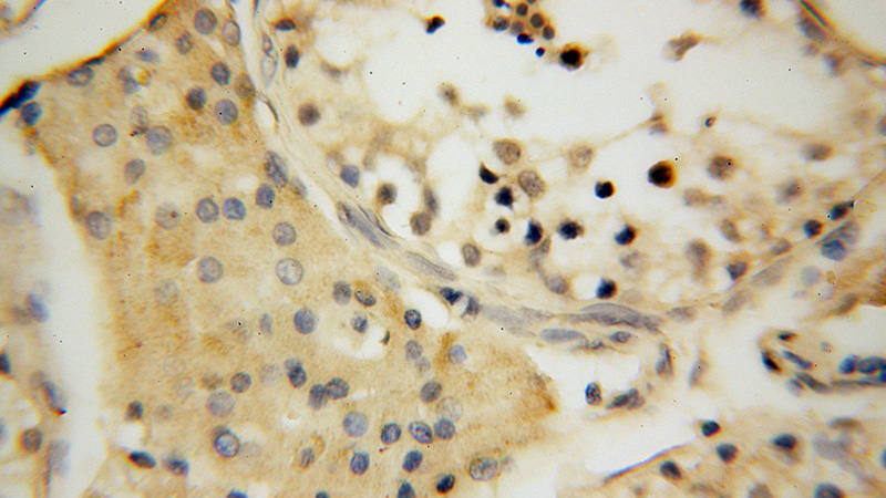 Immunohistochemical of paraffin-embedded human testis using Catalog No:112815(MRPL19 antibody) at dilution of 1:100 (under 40x lens)
