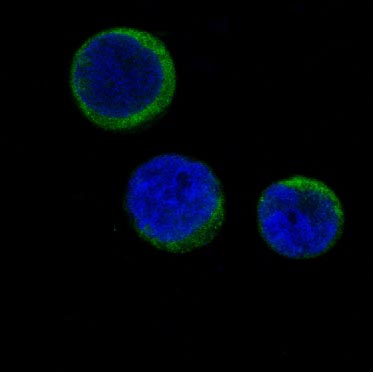Immunofluorescent analysis of Jurkat cells, using Ferritin Antibody.