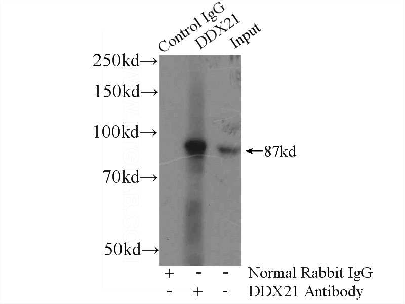IP Result of anti-DDX21 (IP:Catalog No:109821, 4ug; Detection:Catalog No:109821 1:1000) with COLO 320 cells lysate 2800ug.