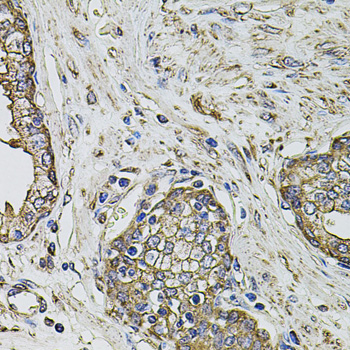 Immunohistochemistry - PTHLH Polyclonal Antibody 