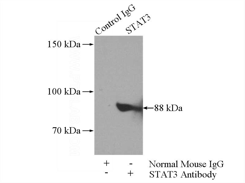 IP Result of anti-STAT3 (IP:Catalog No:107606, 5ug; Detection:Catalog No:107606 1:2000) with HeLa cells lysate 1400ug.