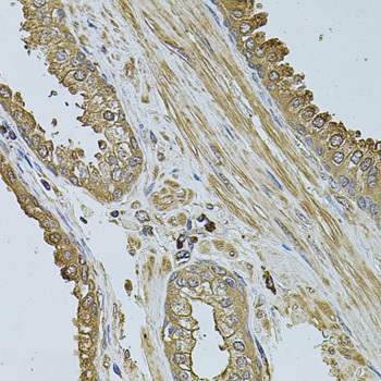 Immunohistochemistry - MYLIP Polyclonal Antibody 
