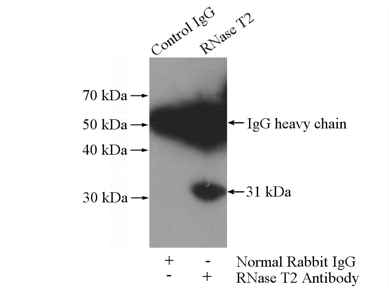 IP Result of anti-RNASET2 (IP:Catalog No:114725, 4ug; Detection:Catalog No:114725 1:300) with BxPC-3 cells lysate 4000ug.