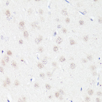 Immunohistochemistry - Bcl9 Polyclonal Antibody 