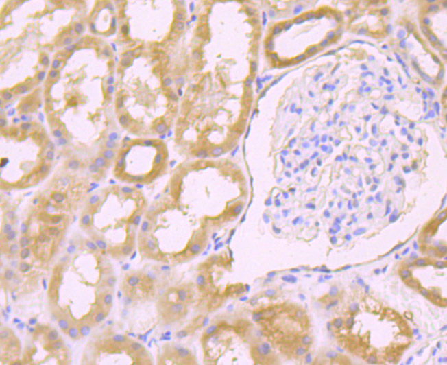 Fig4:; Immunohistochemical analysis of paraffin-embedded human kidney tissue using anti-Galectin 8 antibody. The section was pre-treated using heat mediated antigen retrieval with Tris-EDTA buffer (pH 8.0-8.4) for 20 minutes.The tissues were blocked in 5% BSA for 30 minutes at room temperature, washed with ddH; 2; O and PBS, and then probed with the primary antibody ( 1/50) for 30 minutes at room temperature. The detection was performed using an HRP conjugated compact polymer system. DAB was used as the chromogen. Tissues were counterstained with hematoxylin and mounted with DPX.