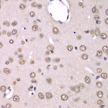 Immunohistochemistry - HNRNPM Polyclonal Antibody 