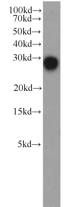 HeLa cells were subjected to SDS PAGE followed by western blot with Catalog No:109765(DCUN1D5 antibody) at dilution of 1:500