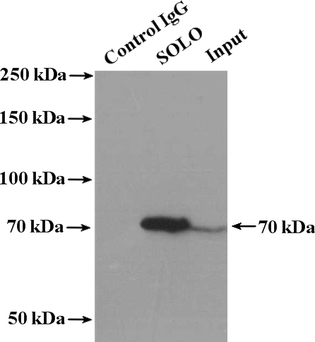 IP Result of anti-SESTD1 (IP:Catalog No:115498, 4ug; Detection:Catalog No:115498 1:1000) with mouse brain tissue lysate 3000ug.