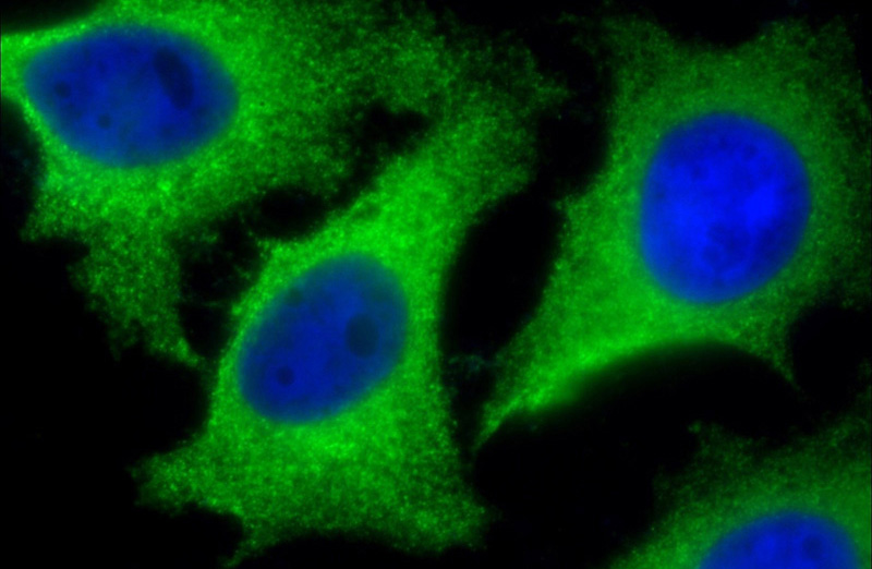 Immunofluorescent analysis of (10% Formaldehyde) fixed HeLa cells using Catalog No:109406(CLTB Antibody) at dilution of 1:100 and Alexa Fluor 488-congugated AffiniPure Goat Anti-Rabbit IgG(H+L)