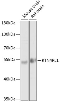 Western blot - RTN4RL1 Polyclonal Antibody 