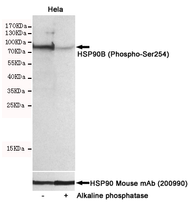 Western blot detection of HSP90B (Phospho-Ser254) in Hela cells untreated or treated with Alkaline phosphatase using HSP90B (Phospho-Ser254) Rabbit pAb (dilution 1:500, upper) HSP90 Mouse mAb (200990, lower).Predicted band size:90kDa.Observed band size:90kDa.