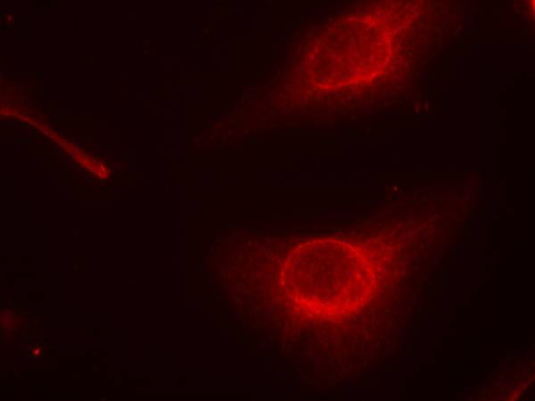 Immunofluorescence staining of methanol-fixed Hela cells using cofilin (Phospho-Ser3) Antibody .