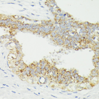 Immunohistochemistry - CD168 Polyclonal Antibody 