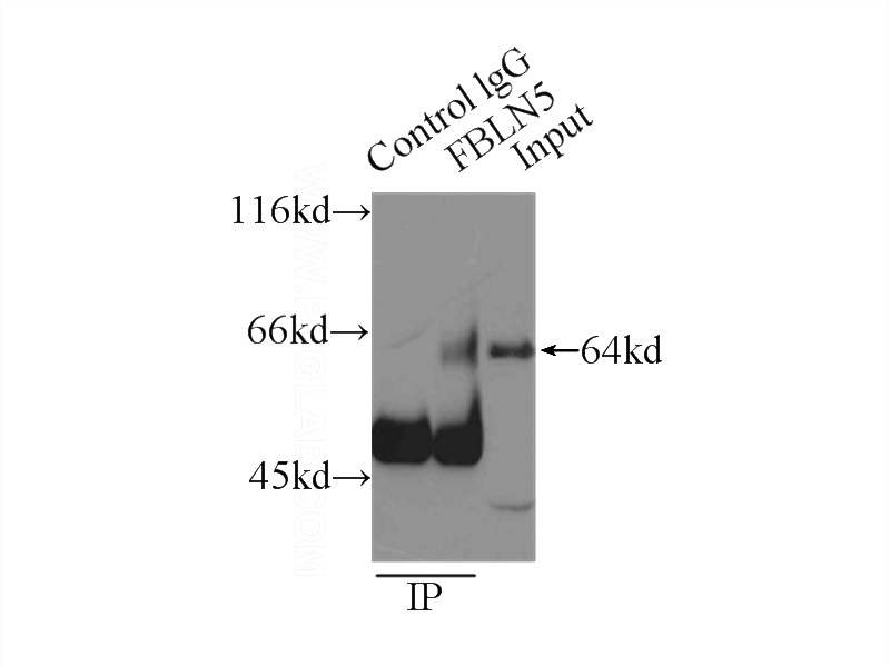 IP Result of anti-FBLN5 (IP:Catalog No:110661, 3ug; Detection:Catalog No:110661 1:300) with mouse heart tissue lysate 8000ug.