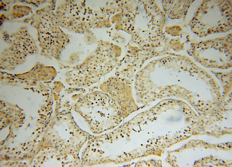 Immunohistochemical of paraffin-embedded human testis using Catalog No:112815(MRPL19 antibody) at dilution of 1:100 (under 10x lens)