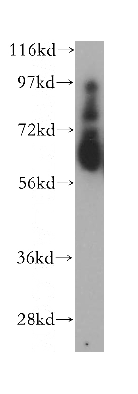 human heart tissue were subjected to SDS PAGE followed by western blot with Catalog No:112989(MYoc antibody) at dilution of 1:300