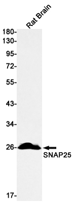Western blot detection of SNAP25 in Rat Brain lysates using SNAP25 Rabbit mAb(1:1000 diluted).Predicted band size:23kDa.Observed band size:25kDa.
