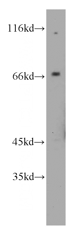 mouse liver tissue were subjected to SDS PAGE followed by western blot with Catalog No:108883(SLC7A1 antibody) at dilution of 1:800