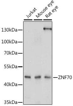 Western blot - ZNF70 Polyclonal Antibody 