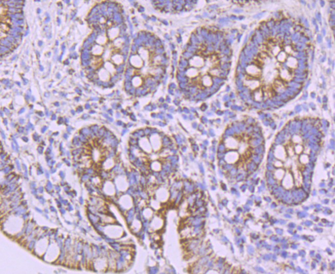 Fig5:; Immunohistochemical analysis of paraffin-embedded human small intestine tissue using anti-NDUFB8 antibody. The section was pre-treated using heat mediated antigen retrieval with Tris-EDTA buffer (pH 8.0-8.4) for 20 minutes.The tissues were blocked in 5% BSA for 30 minutes at room temperature, washed with ddH; 2; O and PBS, and then probed with the primary antibody ( 1/50) for 30 minutes at room temperature. The detection was performed using an HRP conjugated compact polymer system. DAB was used as the chromogen. Tissues were counterstained with hematoxylin and mounted with DPX.