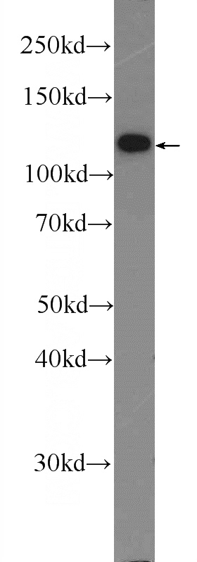 mouse brain tissue were subjected to SDS PAGE followed by western blot with Catalog No:113049(SLC8A1 Antibody) at dilution of 1:1000