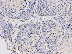 Fig2: Immunohistochemical analysis of paraffin-embedded mouse teratoma tissue using anti-Stella rabbit polyclonal antibody.