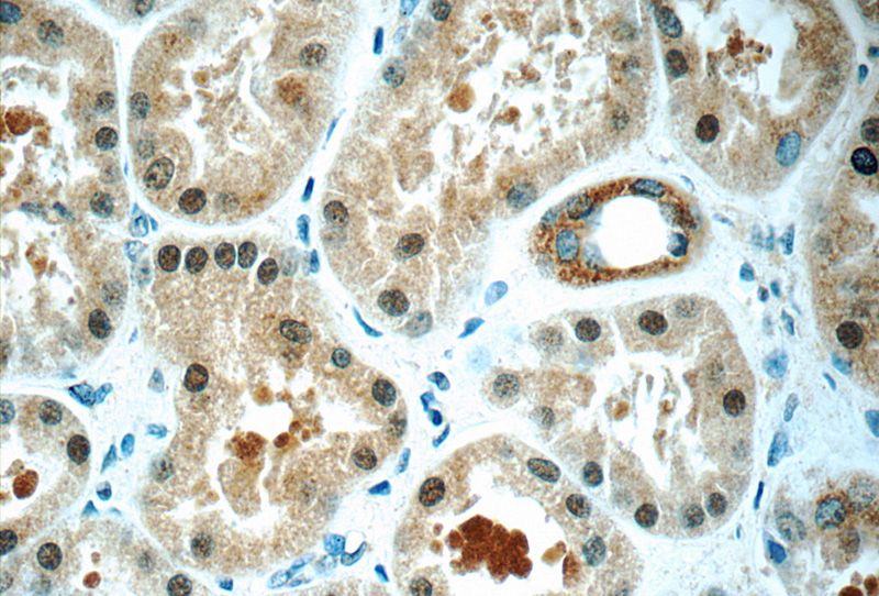Immunohistochemistry of paraffin-embedded human kidney tissue slide using Catalog No:114445(RAB3GAP1 Antibody) at dilution of 1:50 (under 40x lens)
